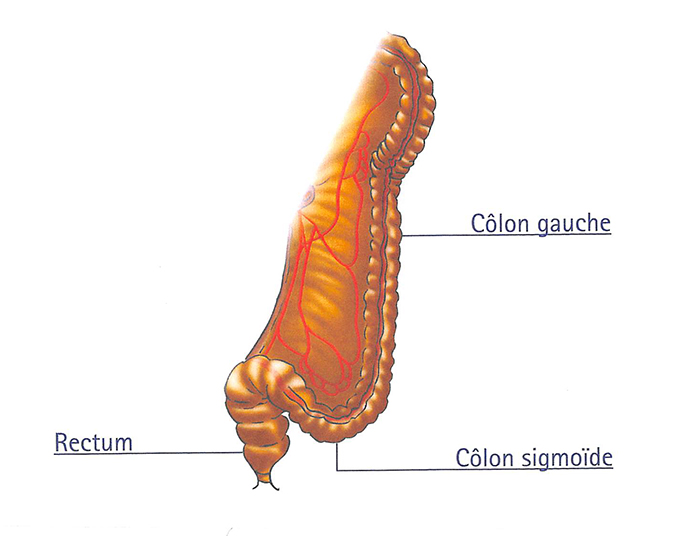 chirurgie_rectum