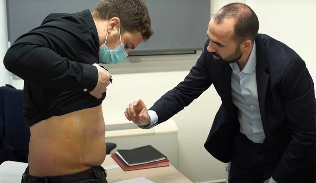 Chirurgie de la hernie inguinale par coelioscopie : témoignages et suivi post-opératoire (vidéos)